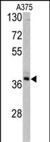 TALDO1 Antibody in Western Blot (WB)