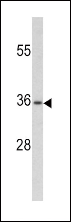 PAX4 Antibody in Western Blot (WB)