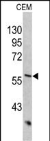 Cytokeratin 10 Antibody in Western Blot (WB)