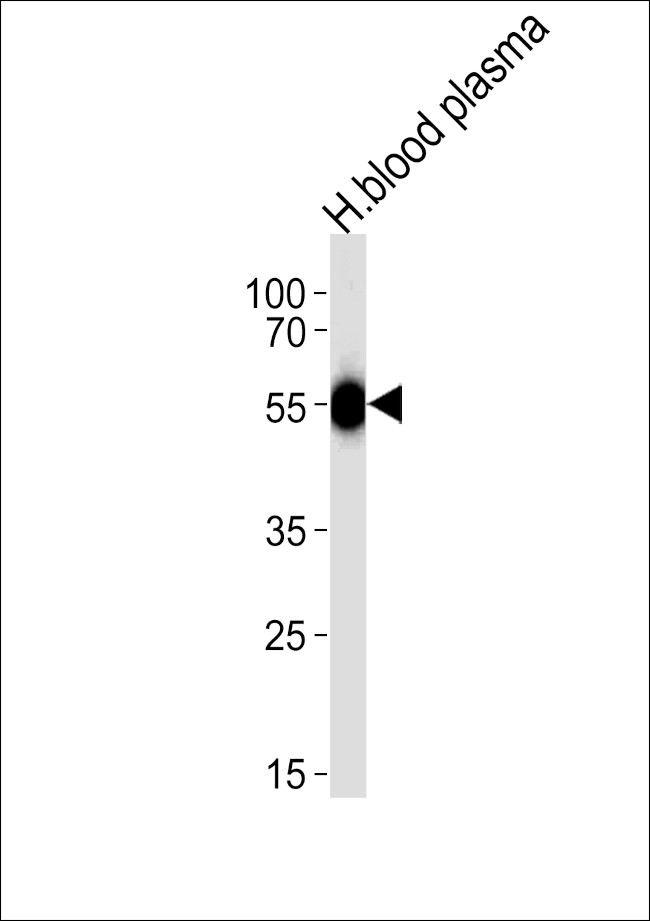 SERPINC1 Antibody in Western Blot (WB)