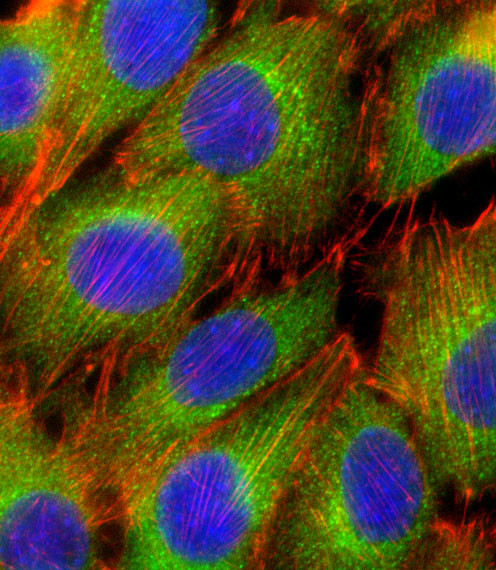 AKT2 Antibody in Immunocytochemistry (ICC/IF)