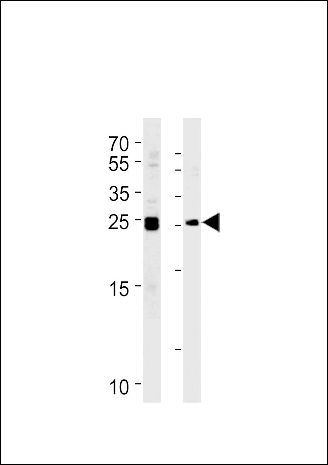 MOB4A Antibody in Western Blot (WB)