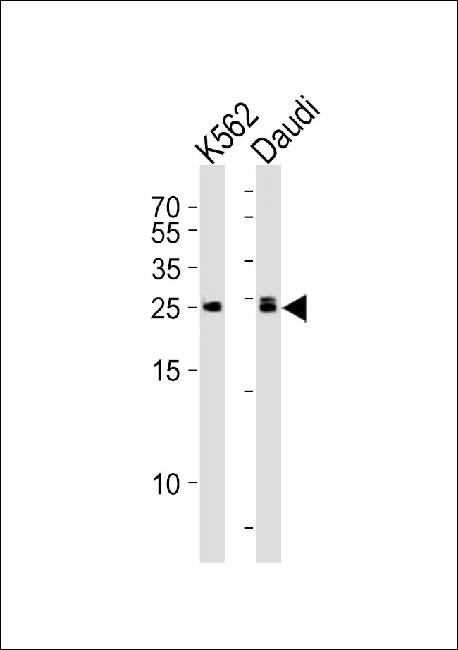 MOB4A Antibody in Western Blot (WB)