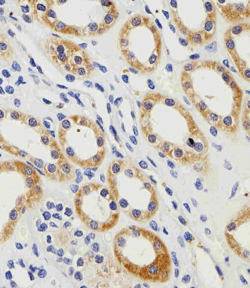 PGK1 Antibody in Immunohistochemistry (Paraffin) (IHC (P))