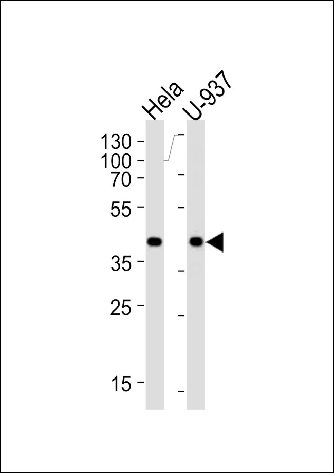 PGK1 Antibody in Western Blot (WB)