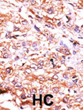 GUCY1A2 Antibody in Immunohistochemistry (Paraffin) (IHC (P))