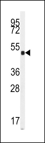 GUCY1A2 Antibody in Western Blot (WB)