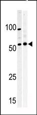 PKMYT1 Antibody in Western Blot (WB)