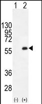 PKMYT1 Antibody in Western Blot (WB)