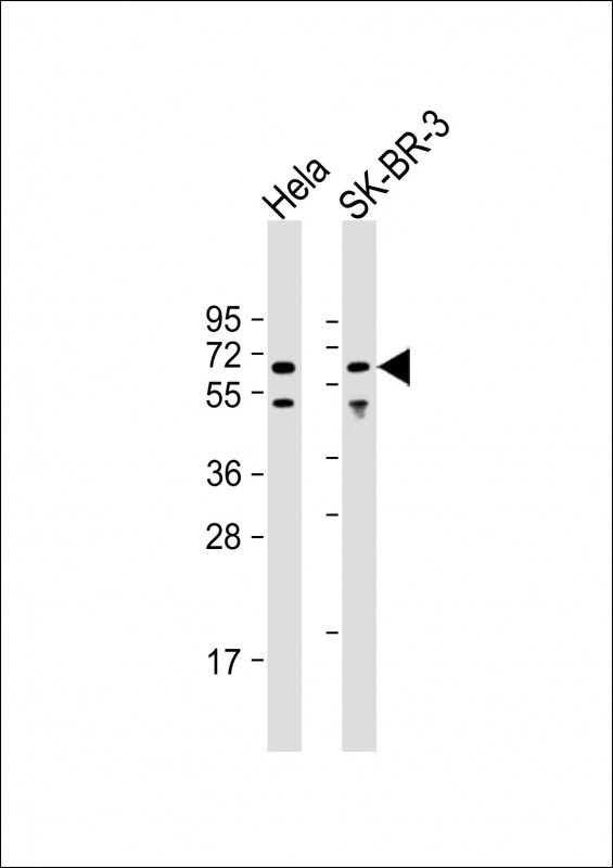 AMPK alpha-1 Antibody in Western Blot (WB)