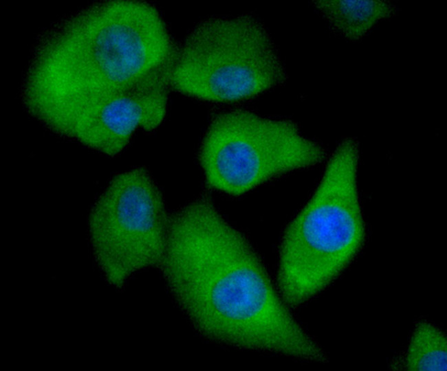 ALDH1A1 Antibody in Immunocytochemistry (ICC/IF)