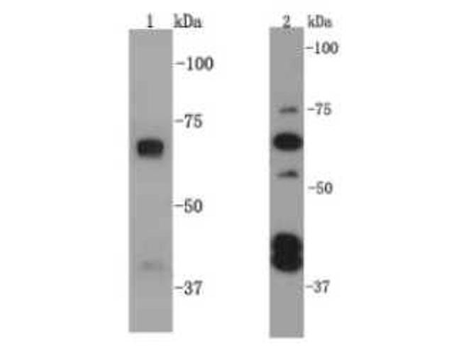 SQSTM1 Antibody in Western Blot (WB)