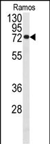 Cdc25B Antibody in Western Blot (WB)