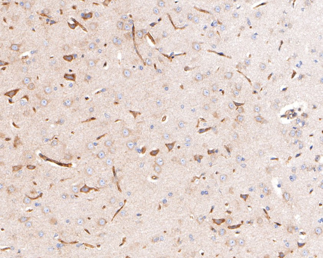 P-Glycoprotein Antibody in Immunohistochemistry (Paraffin) (IHC (P))