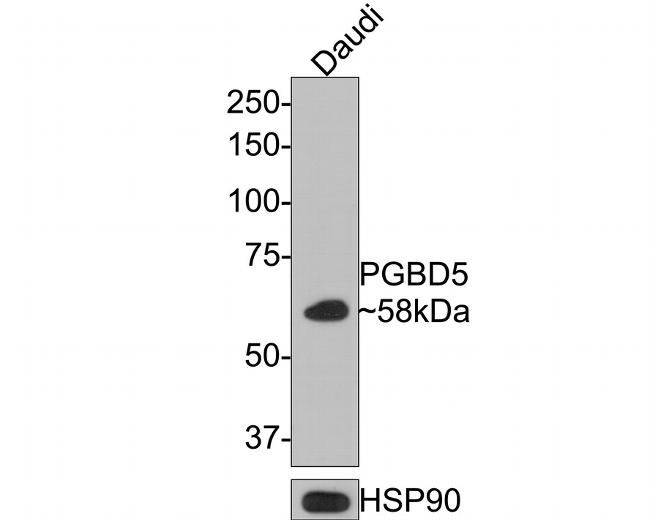 PGBD5 Antibody in Western Blot (WB)
