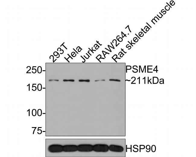 PSME4 Antibody in Western Blot (WB)