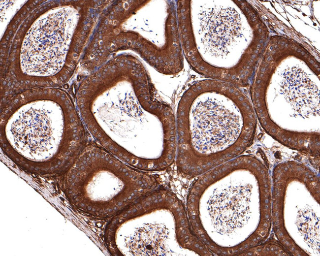 14-3-3 zeta Antibody in Immunohistochemistry (Paraffin) (IHC (P))