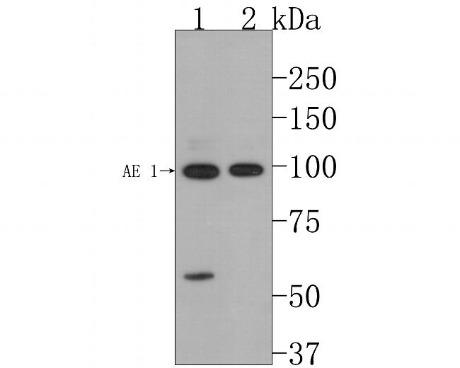 Band 3 Antibody in Western Blot (WB)