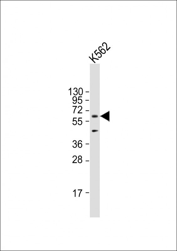 AMPK alpha-1 Antibody in Western Blot (WB)