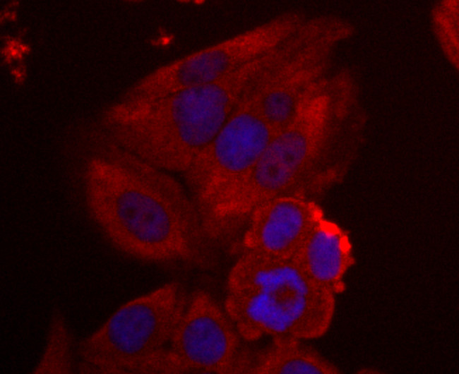 NME1 Antibody in Immunocytochemistry (ICC/IF)