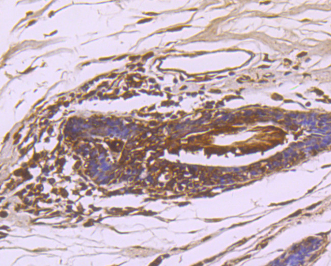 NME1 Antibody in Immunohistochemistry (Paraffin) (IHC (P))