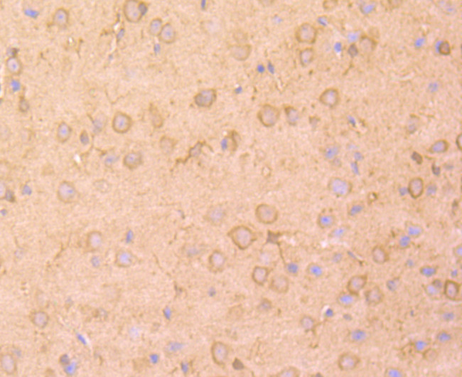 NME1 Antibody in Immunohistochemistry (Paraffin) (IHC (P))