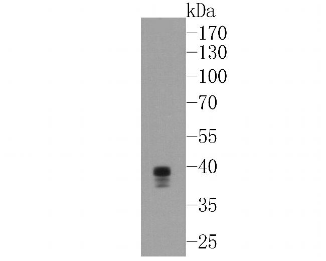 ST2 Antibody in Western Blot (WB)