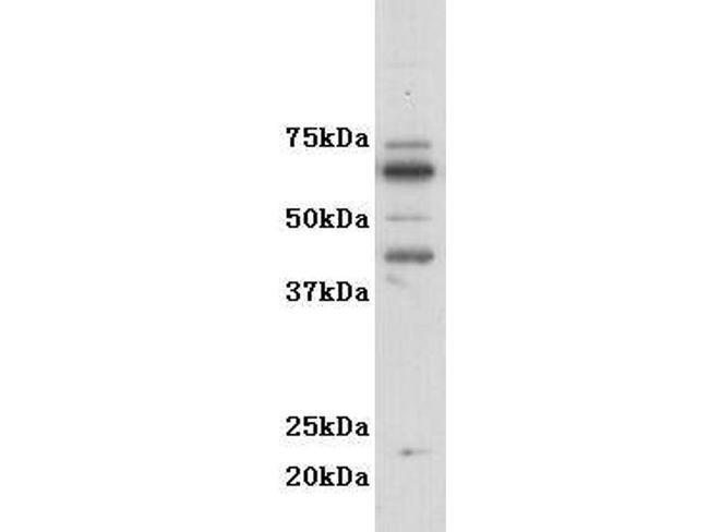 CSF2RA Antibody in Western Blot (WB)