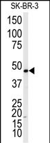 beta-2 Adrenergic Receptor Antibody in Western Blot (WB)
