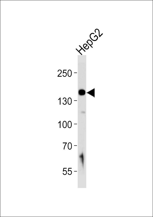 HYOU1 Antibody in Western Blot (WB)