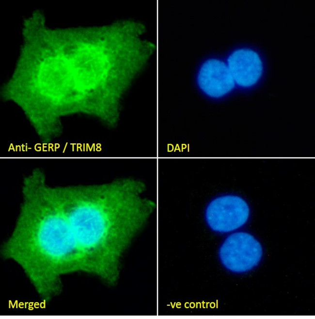 TRIM8 Antibody in Immunocytochemistry (ICC/IF)