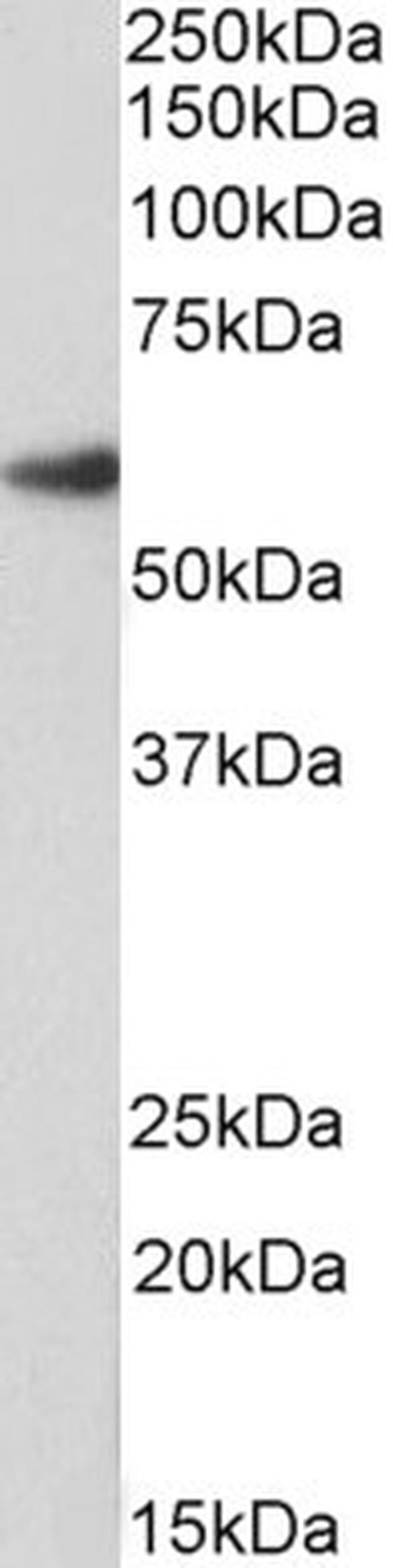 FOXA2 Antibody in Western Blot (WB)