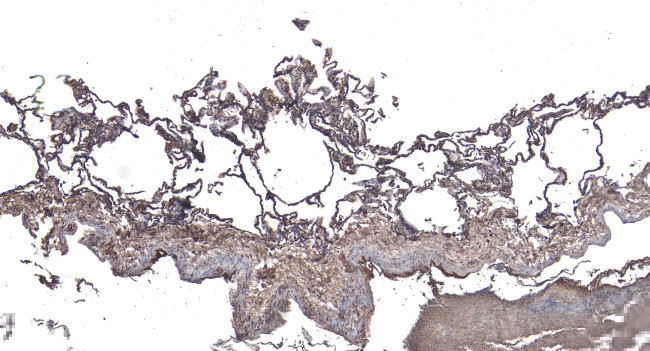 ARAP1 Antibody in Immunohistochemistry (Paraffin) (IHC (P))