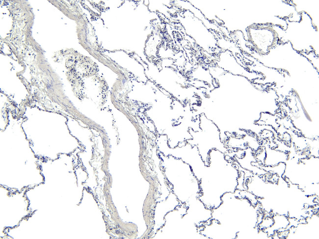 ARAP1 Antibody in Immunohistochemistry (Paraffin) (IHC (P))