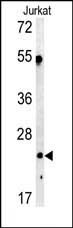 C1QA Antibody in Western Blot (WB)