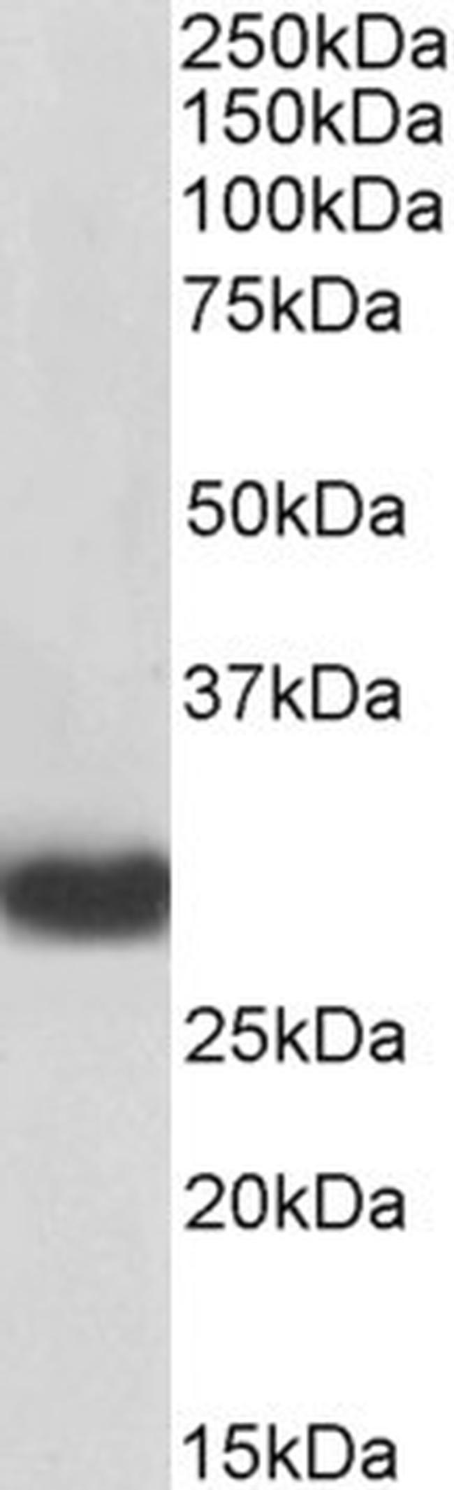 MyD88 Antibody in Western Blot (WB)