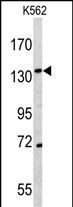 CD163 Antibody in Western Blot (WB)