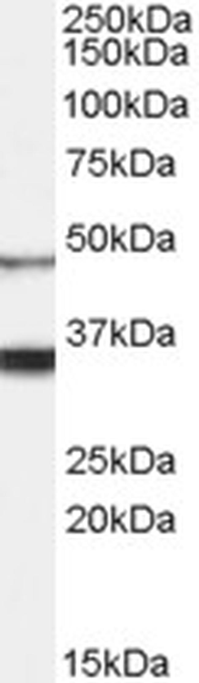 Orexin Receptor 1 Antibody in Western Blot (WB)