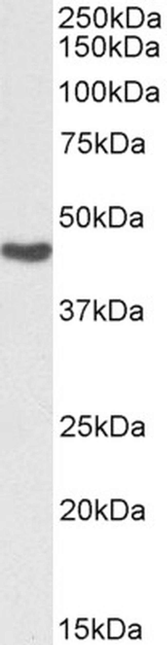 ASS1 Antibody in Western Blot (WB)