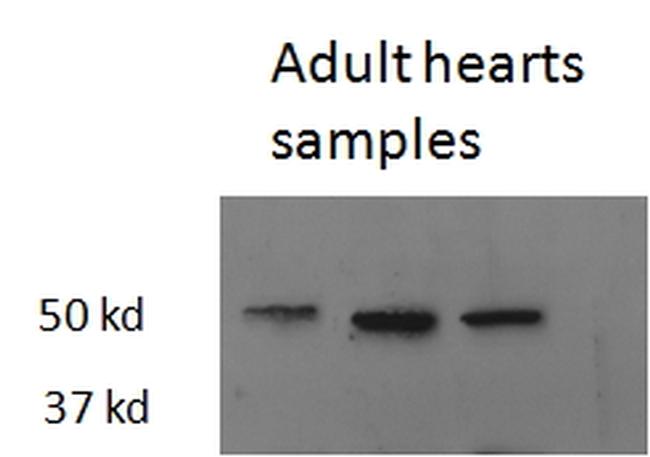 THRB Antibody in Western Blot (WB)