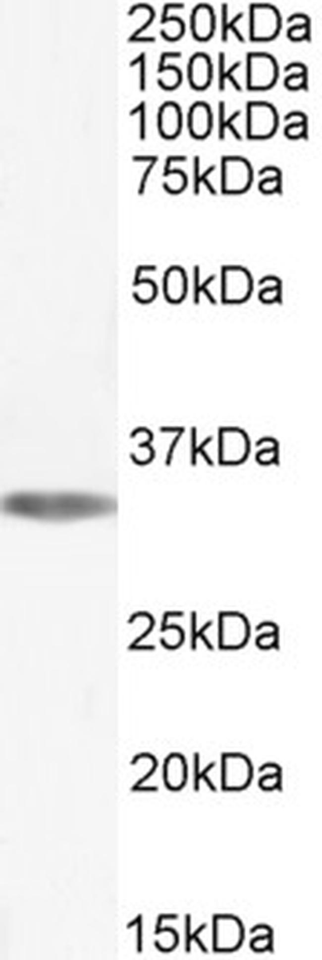 ADORA1 Antibody in Western Blot (WB)