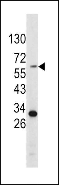 Tyrosinase Antibody in Western Blot (WB)