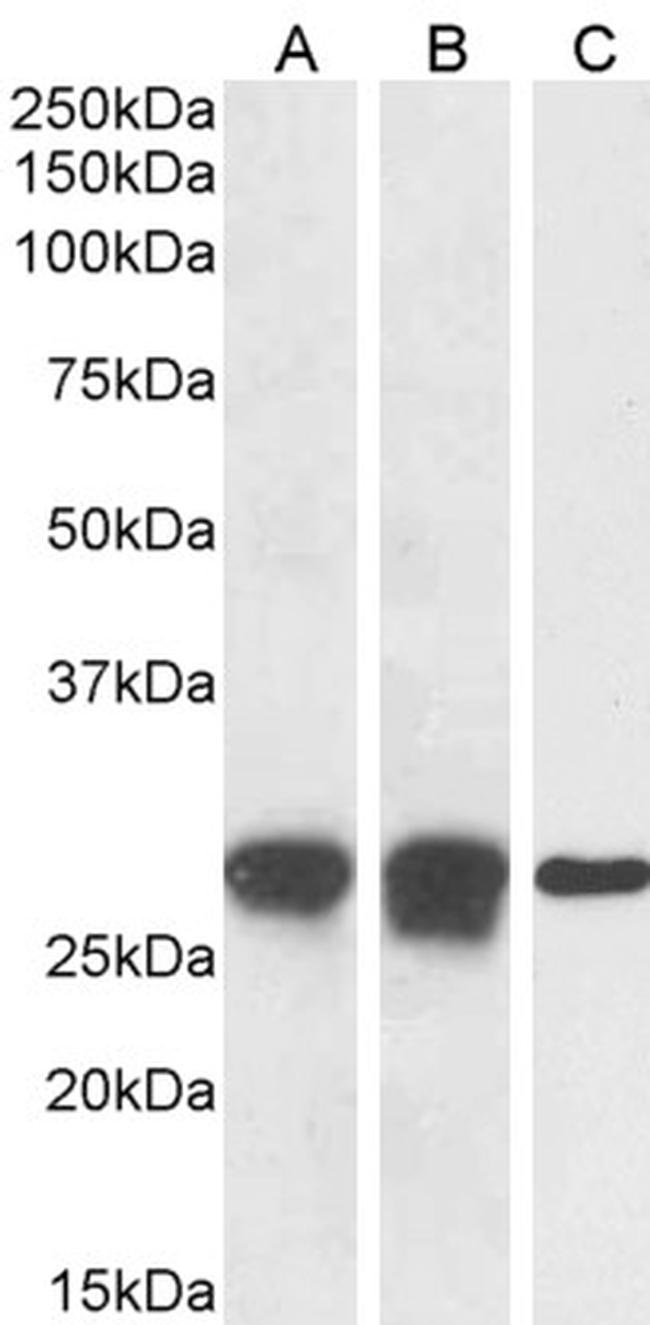 APOBEC3A Antibody in Western Blot (WB)