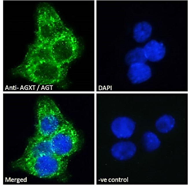 AGXT Antibody in Immunocytochemistry (ICC/IF)