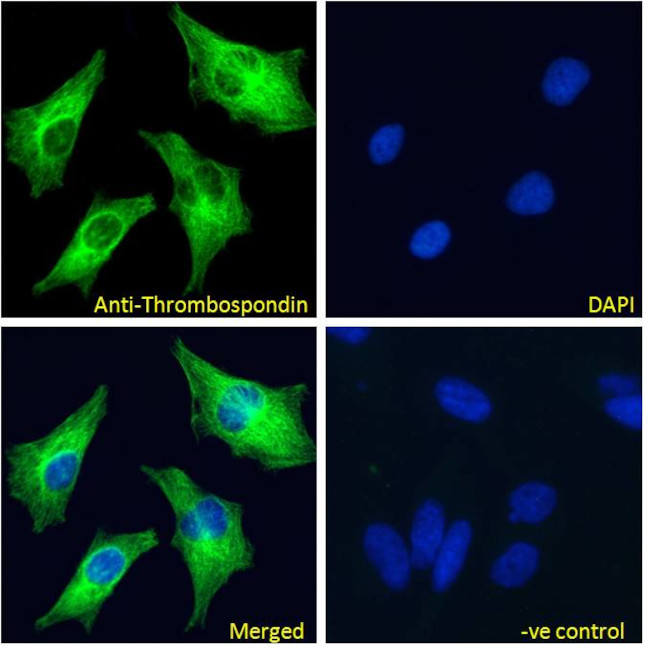 Thrombospondin 1 Antibody in Immunocytochemistry (ICC/IF)