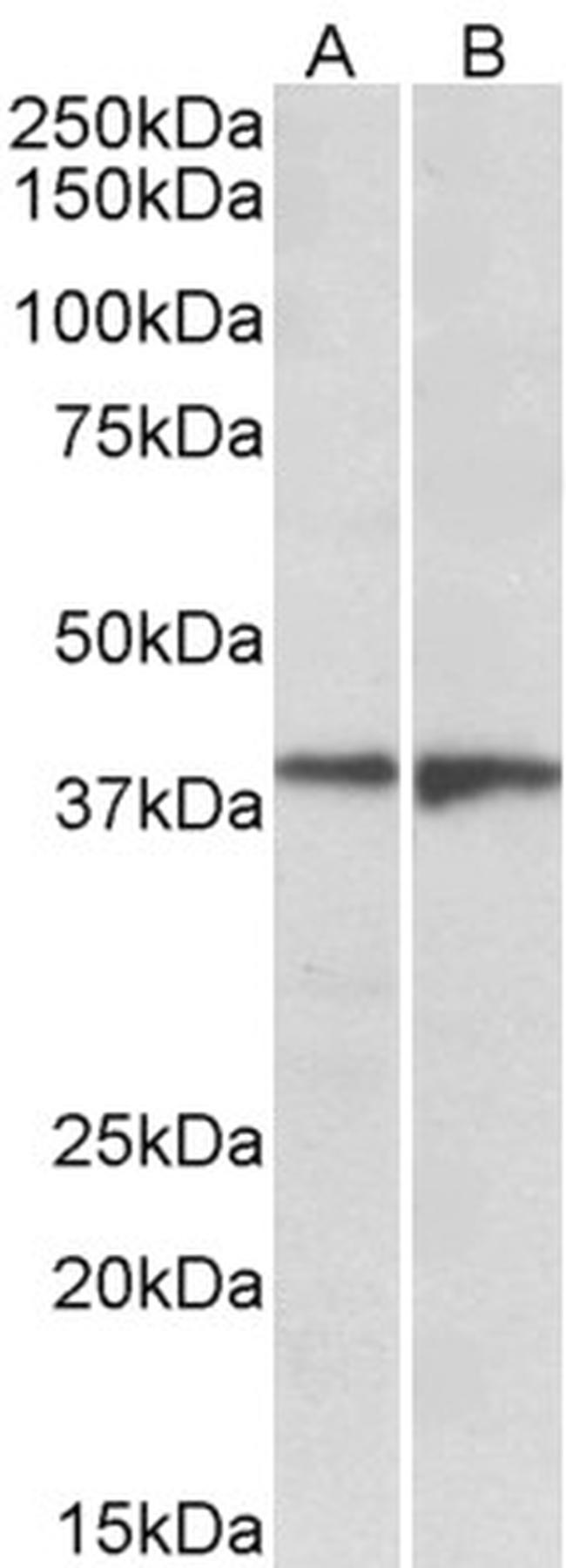 EDG8 Antibody in Western Blot (WB)