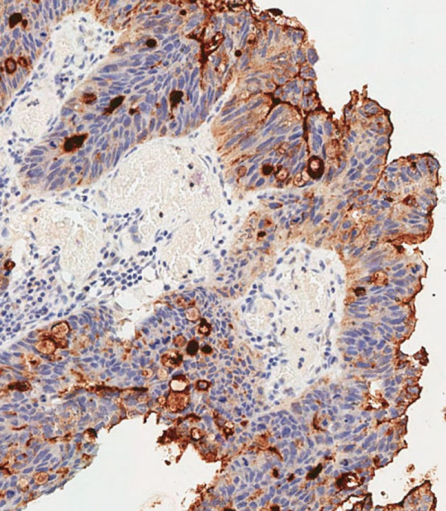 CEACAM1 Antibody in Immunohistochemistry (Paraffin) (IHC (P))