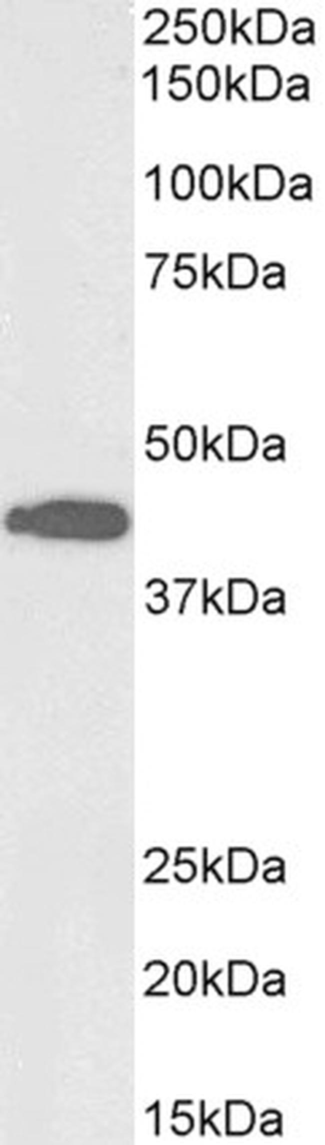 ACAT1 Antibody in Western Blot (WB)