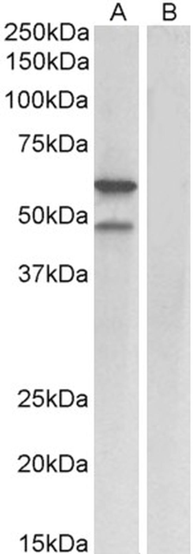 E2F3 Antibody in Western Blot (WB)