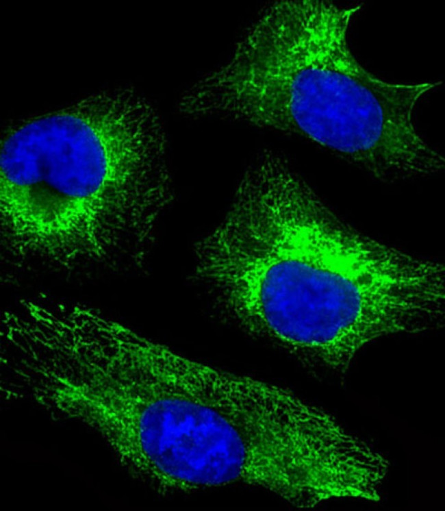 Cytokeratin 18 Antibody in Immunocytochemistry (ICC/IF)